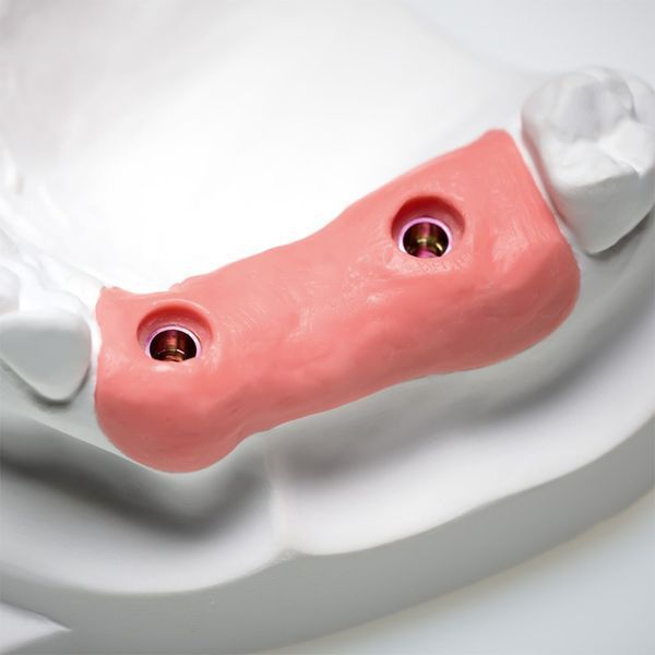 Твердий А-силікон GingiFast Rigid, 2 картриджа по 50 мл C401520 фото