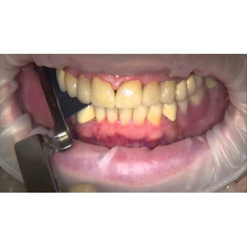 Артикуляційний папір Bausch BK01 200мкм (Бауш БК01) синій, двосторонній BK01 фото